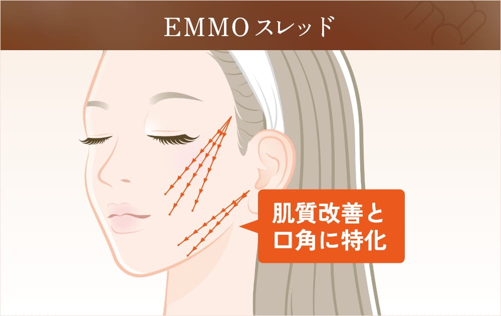 EMMOスレッドの解説図