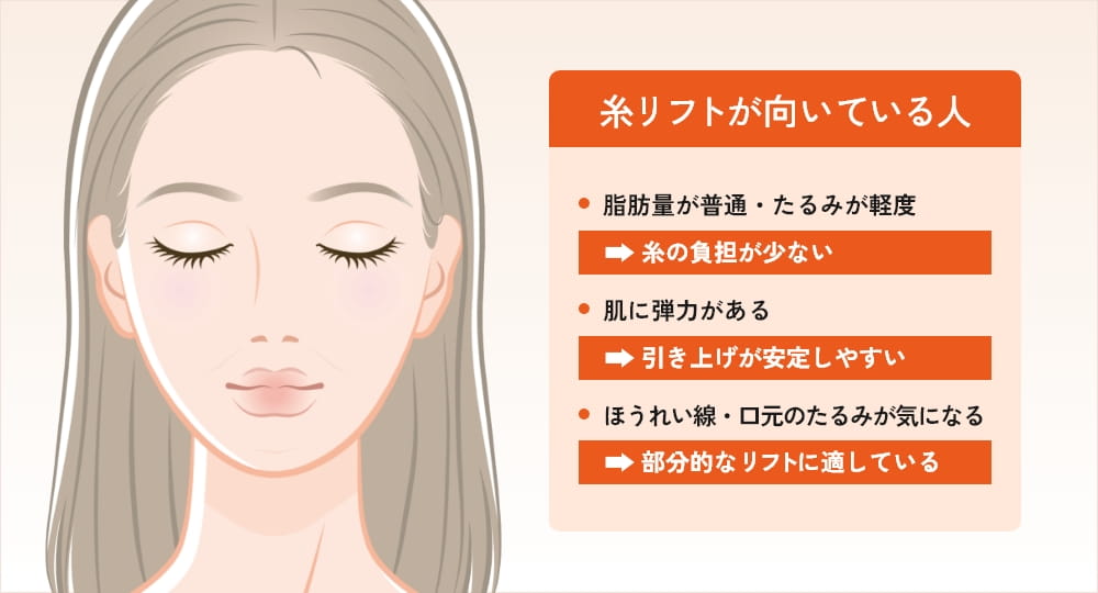 糸リフトに適した人の特徴を示すイラスト