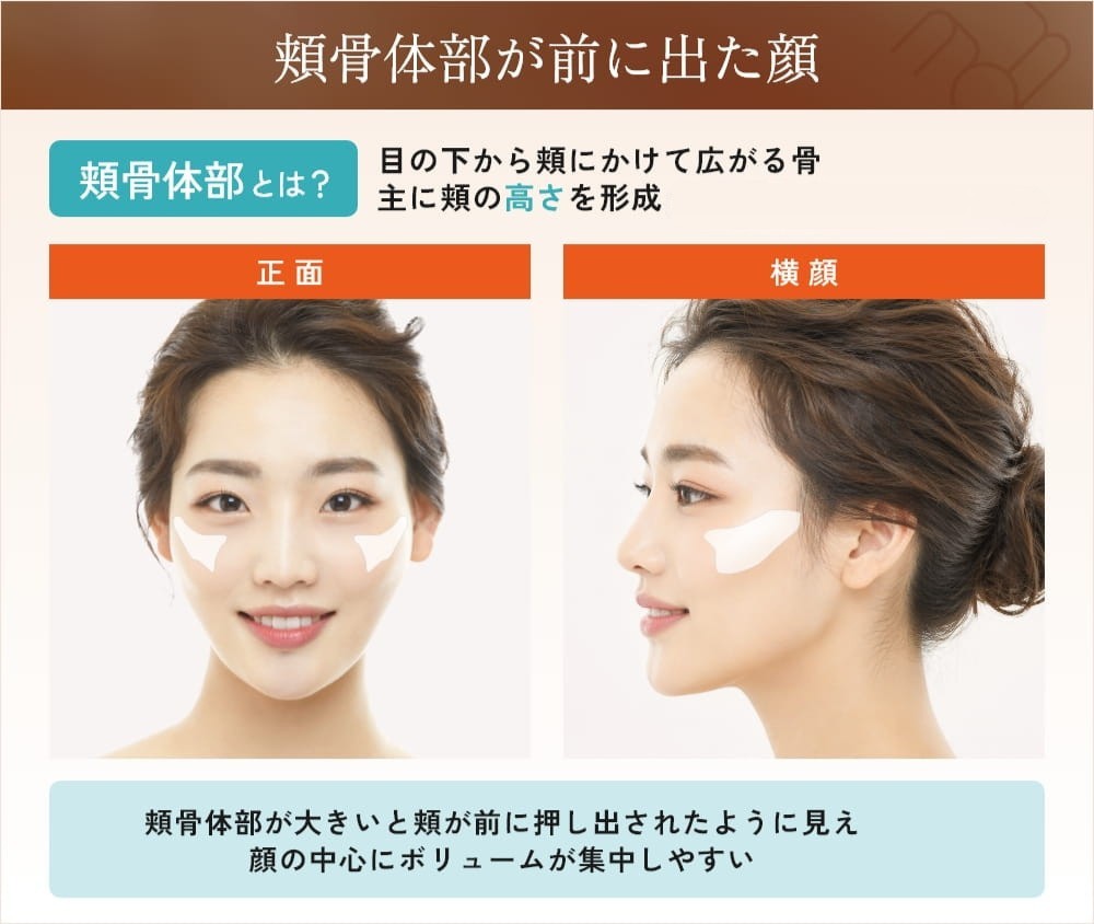 頬骨体部の説明と女性の顔の正面と横顔