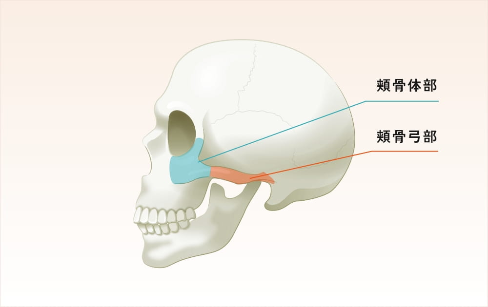 頬骨と頬骨弓を示す頭蓋骨の側面図