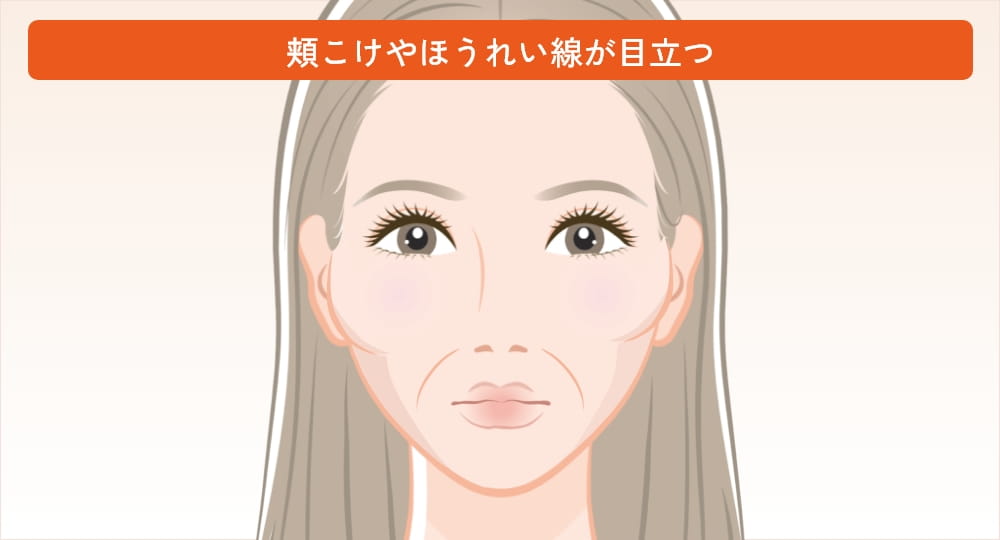 頬がこけてほうれい線が目立つ女性の顔