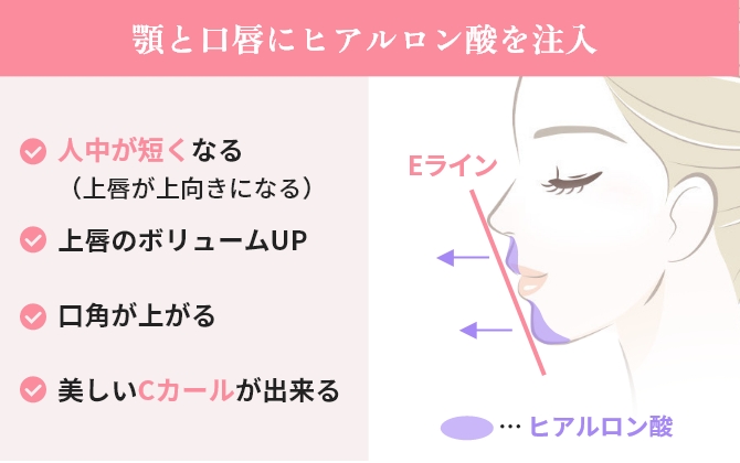 .口元黄金比セット