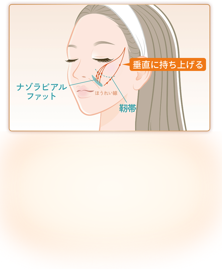 顔の頬のたるみとリフトアップのメカニズム
