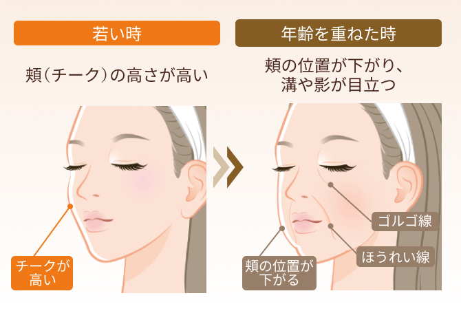 顔の頬のたるみとリフトアップのメカニズム