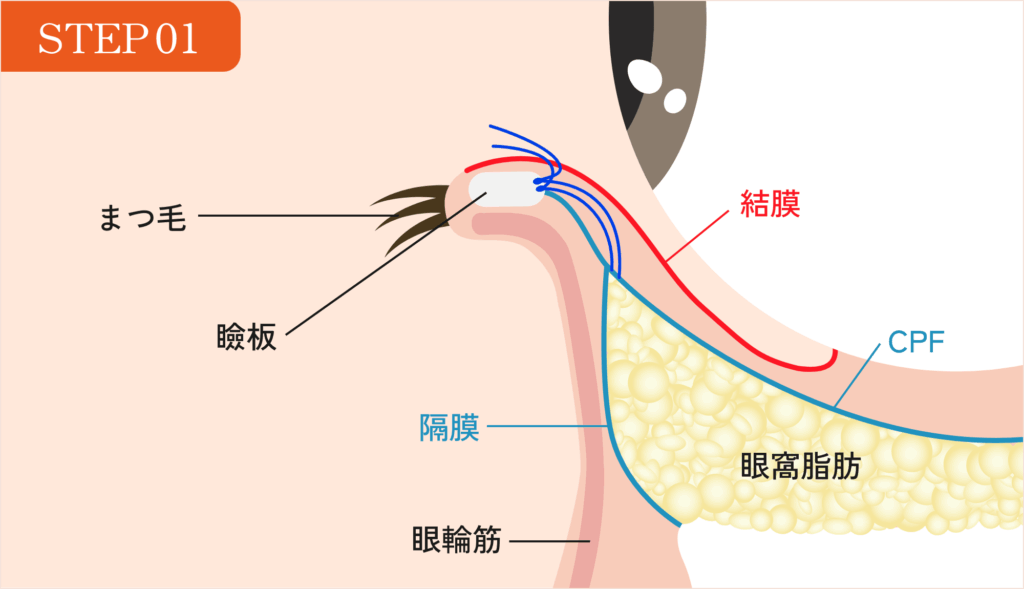 STEP01