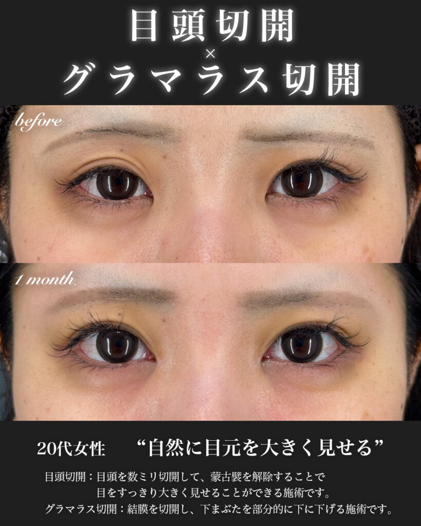 症例写真01
