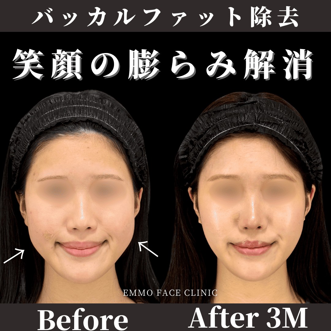 症例写真01