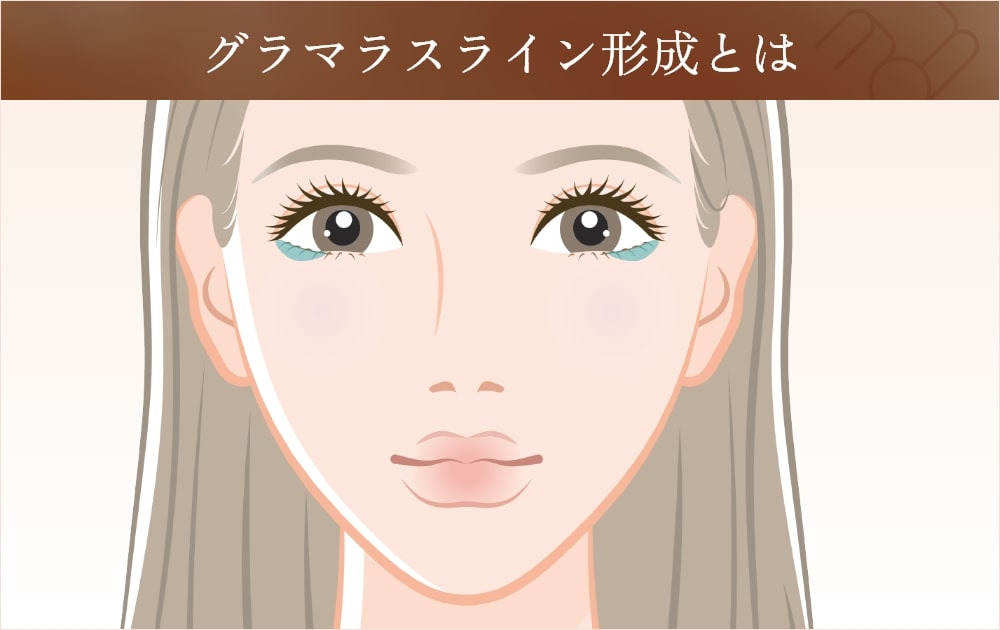 グラマラスライン形成とは
