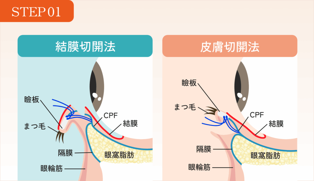 STEP01