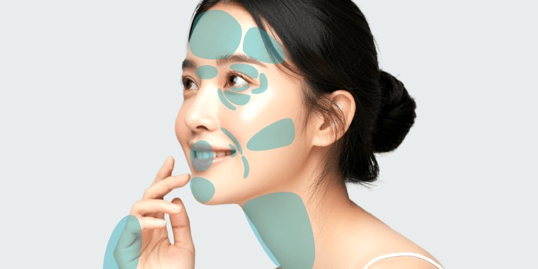 マイクロナノファット脂肪注入