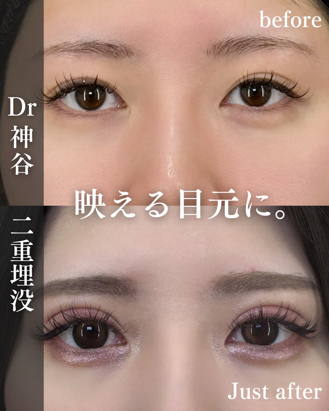 目元 