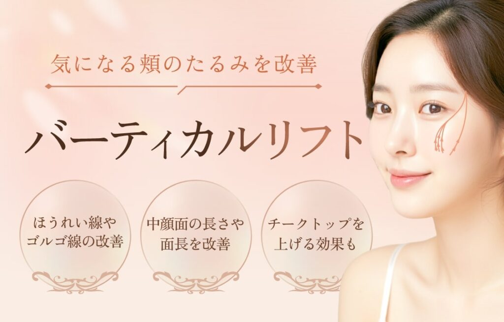 バーティカルリフト