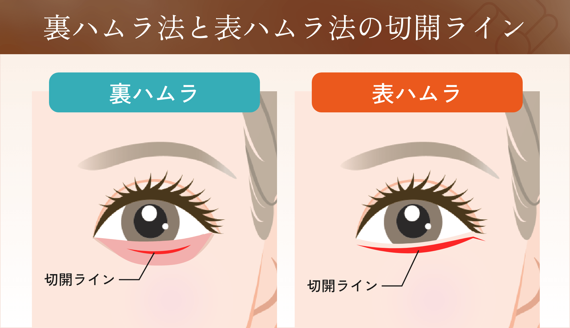 施術箇所