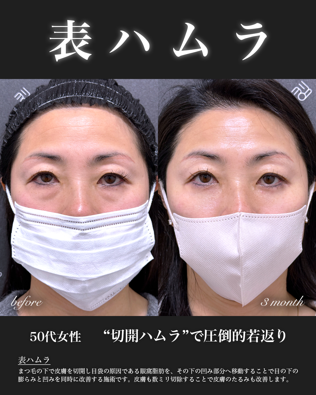 症例写真01