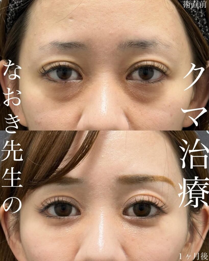 症例写真02