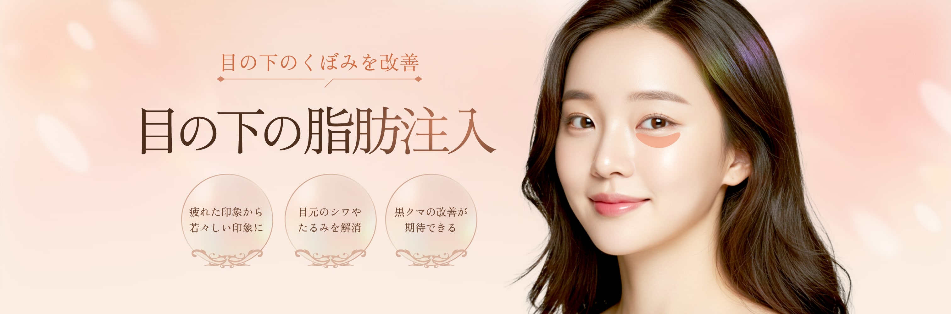 https://emmofaceclinic.com/wp-content/uploads/2025/04/under-eye-fat-injections-pc.jpg