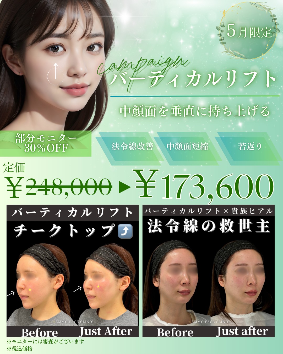 木之下DrーキャンペーンPOP