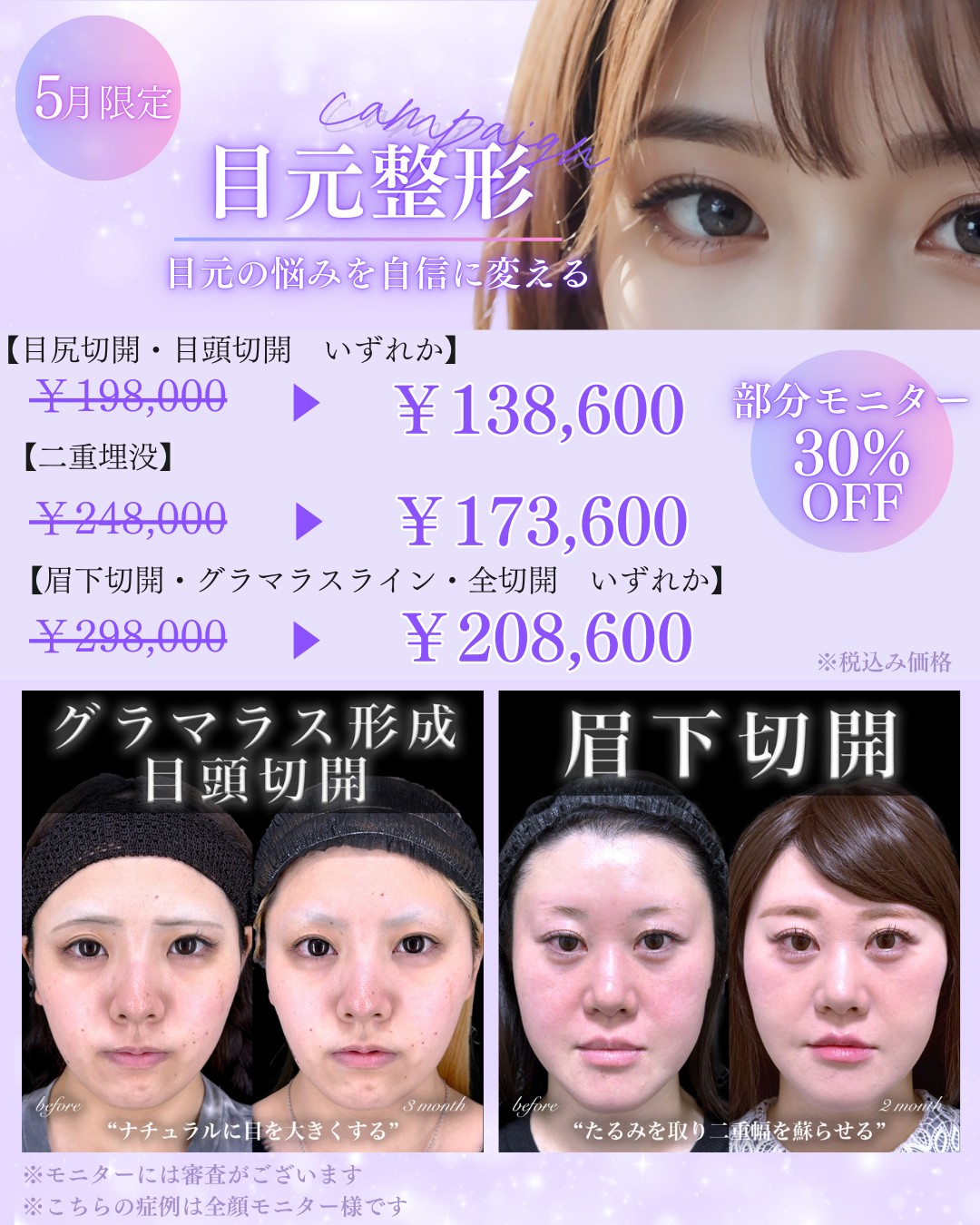 百瀬Drーキャンペーン