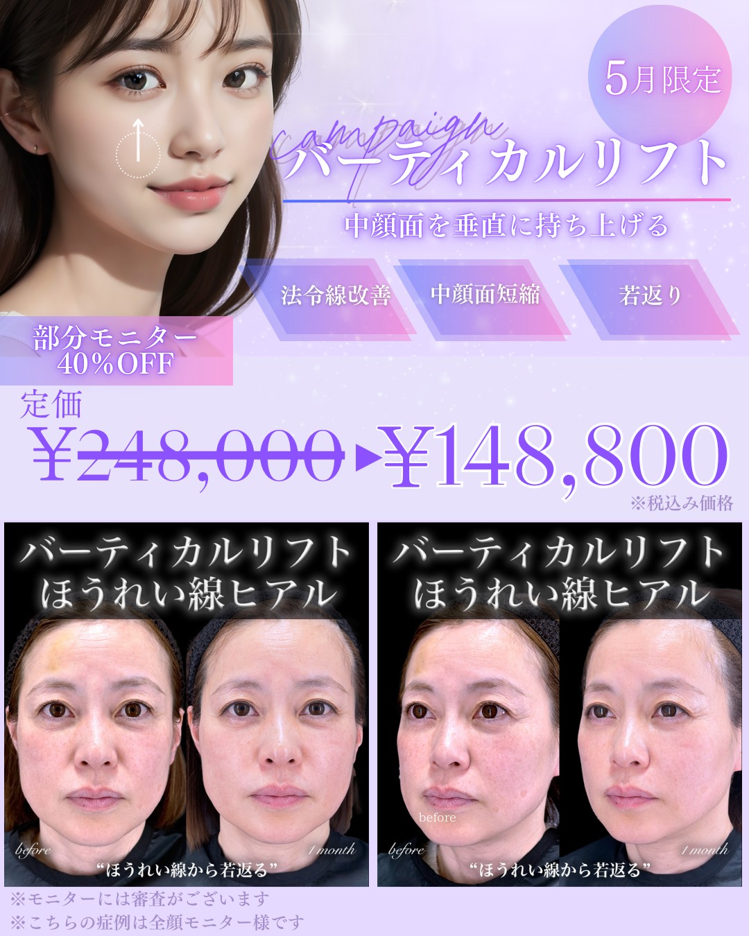 百瀬Drーキャンペーン