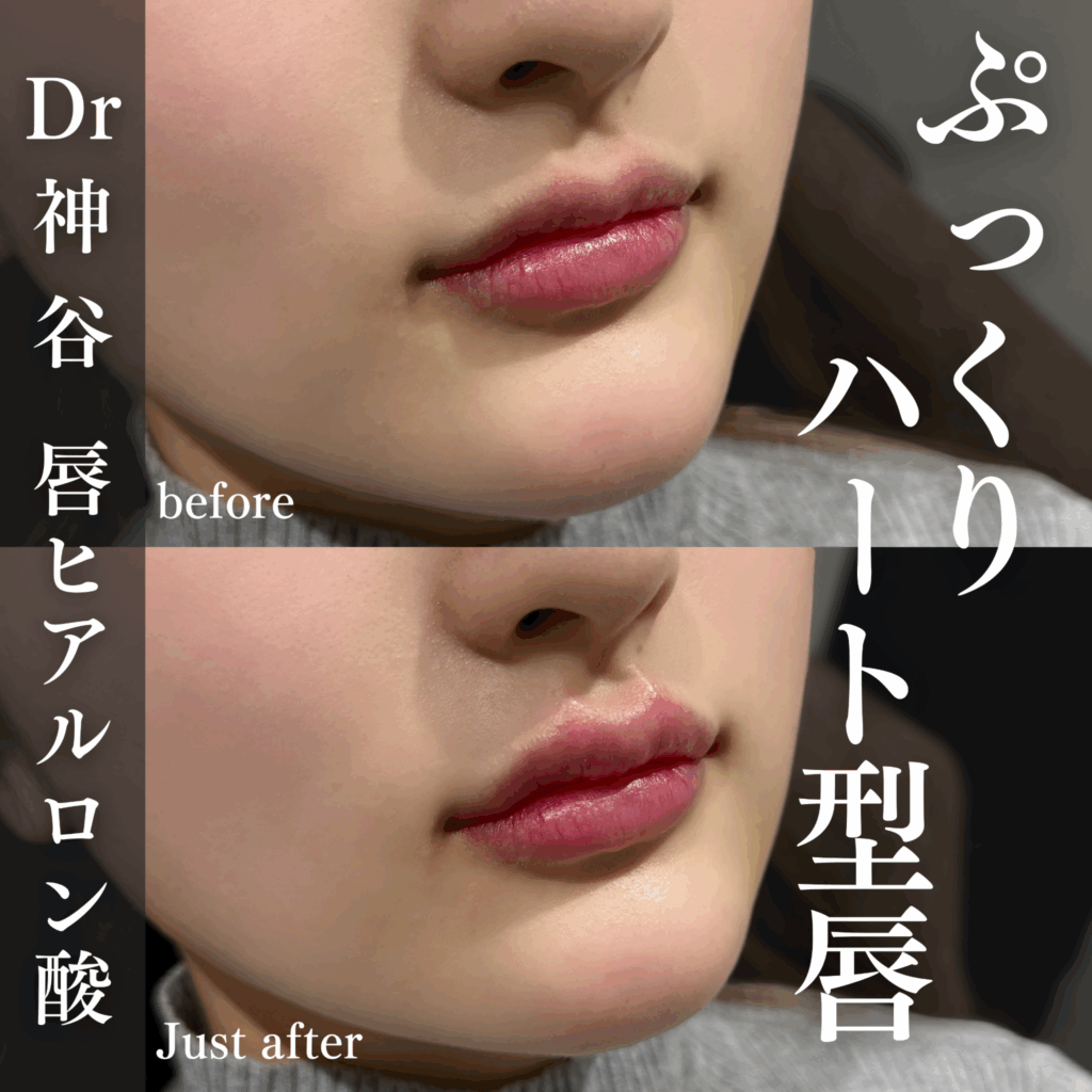 症例写真01