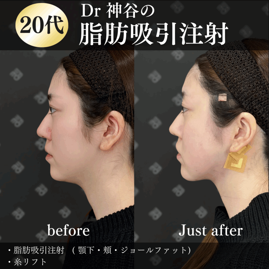 症例写真02