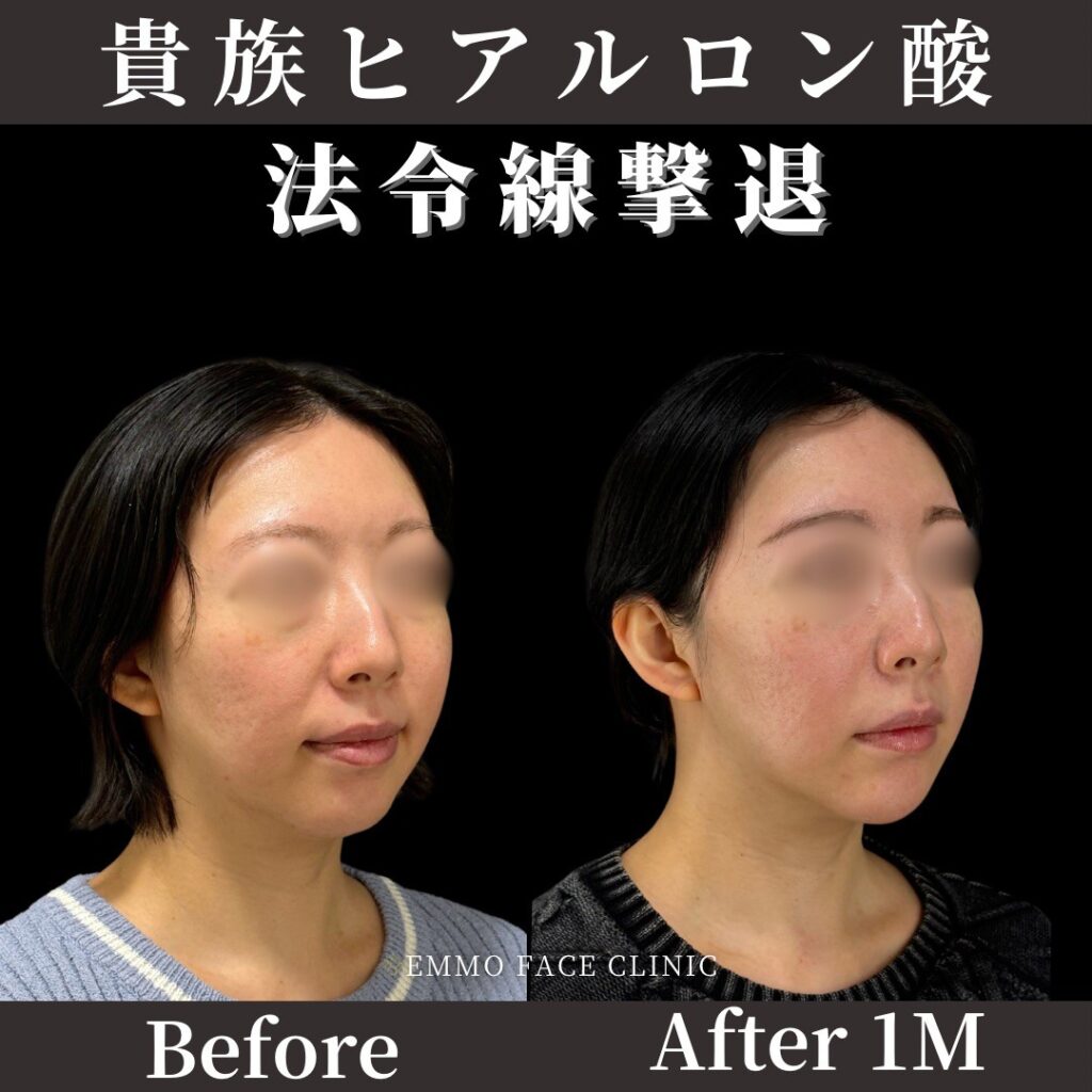 症例写真02