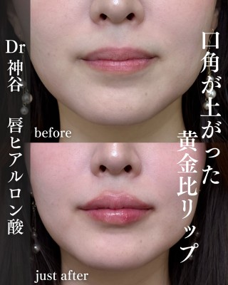 症例写真03