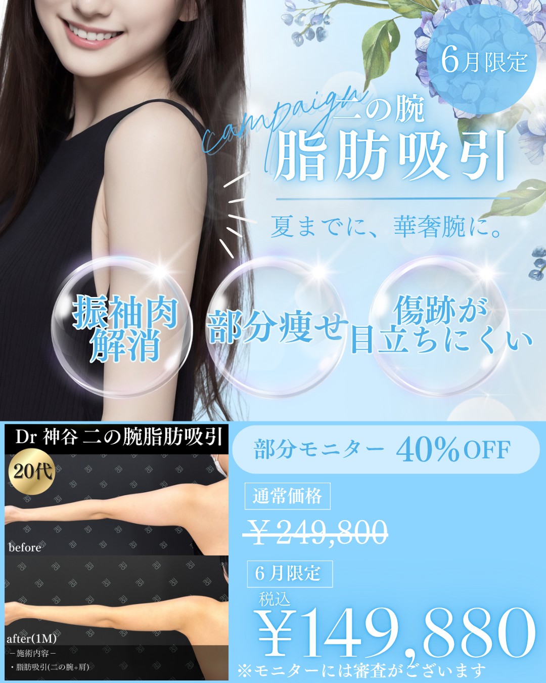 キャンペーン