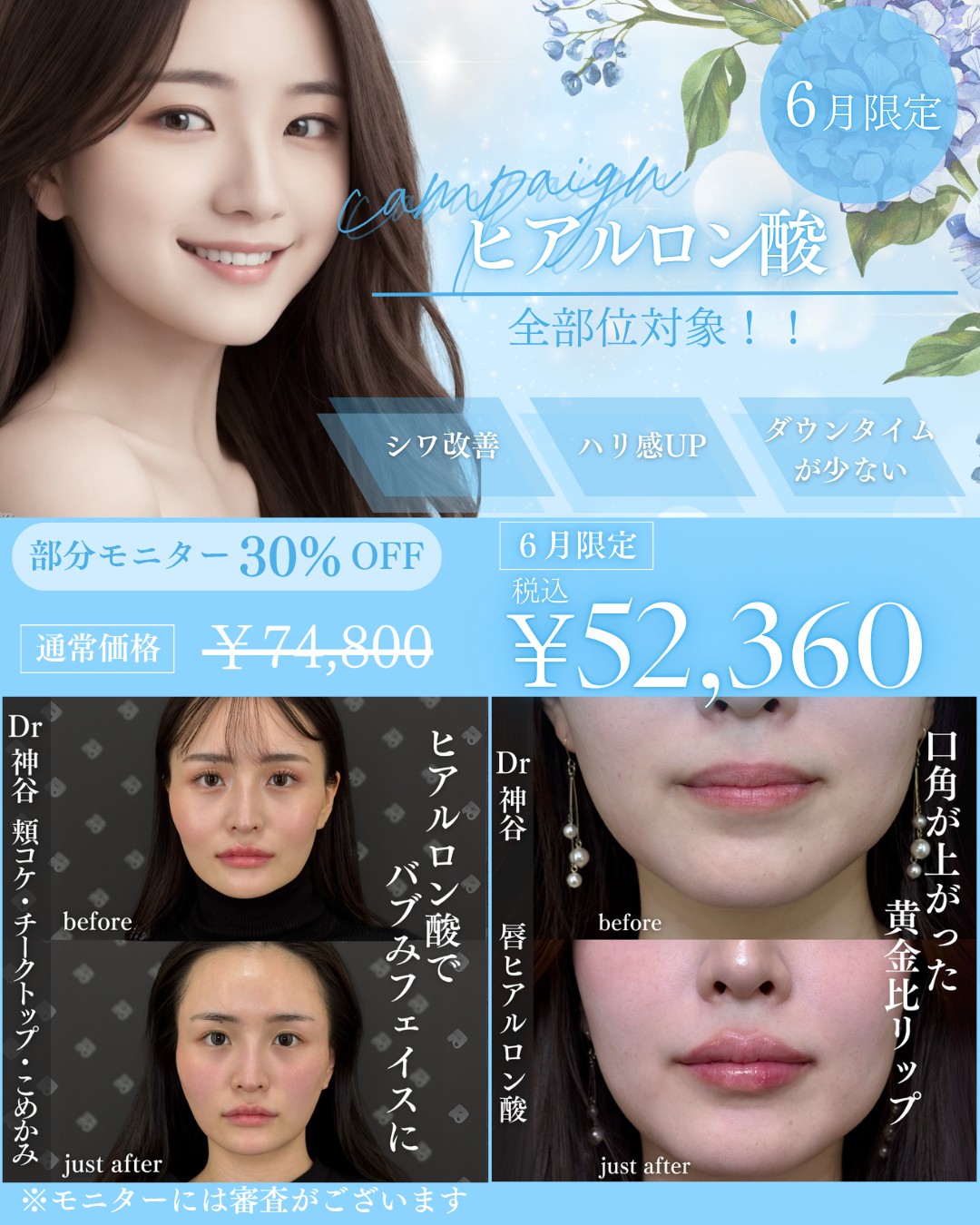キャンペーン