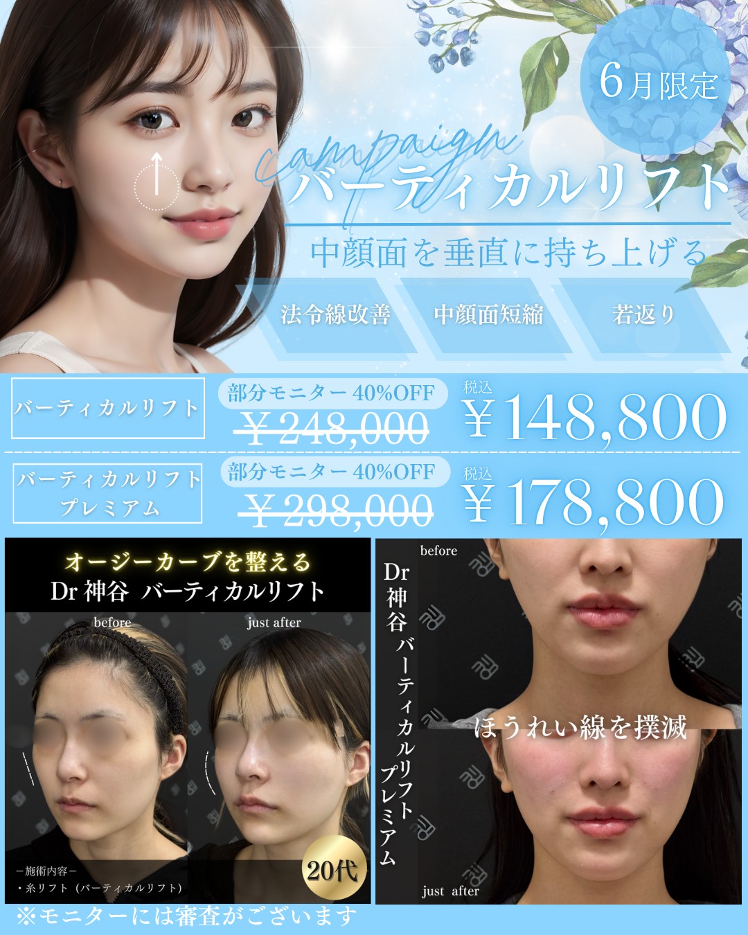 キャンペーン