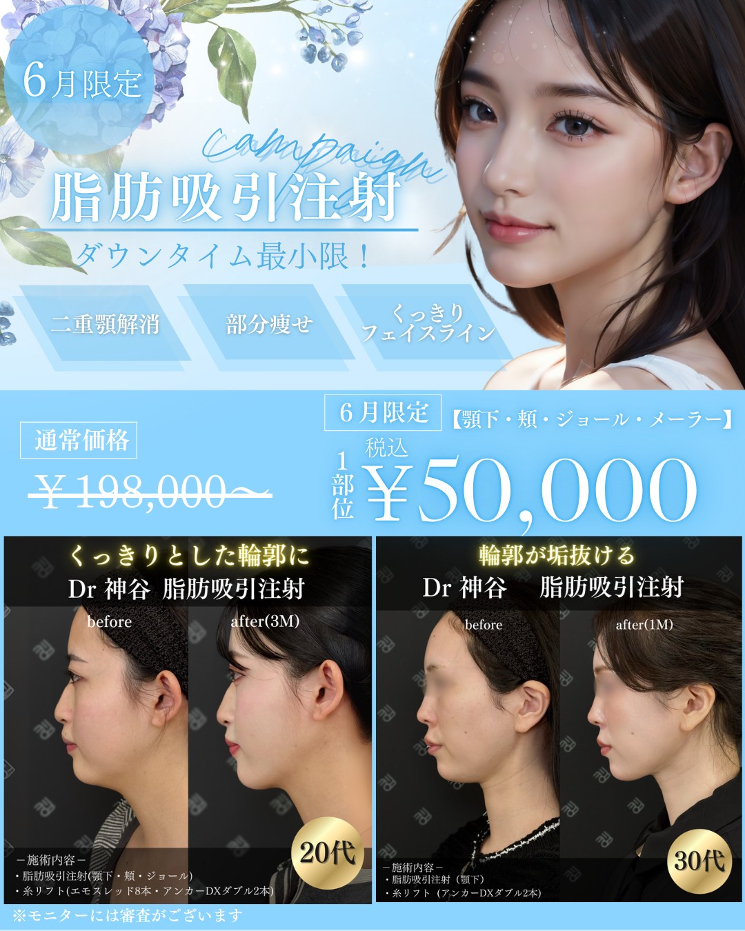 キャンペーン