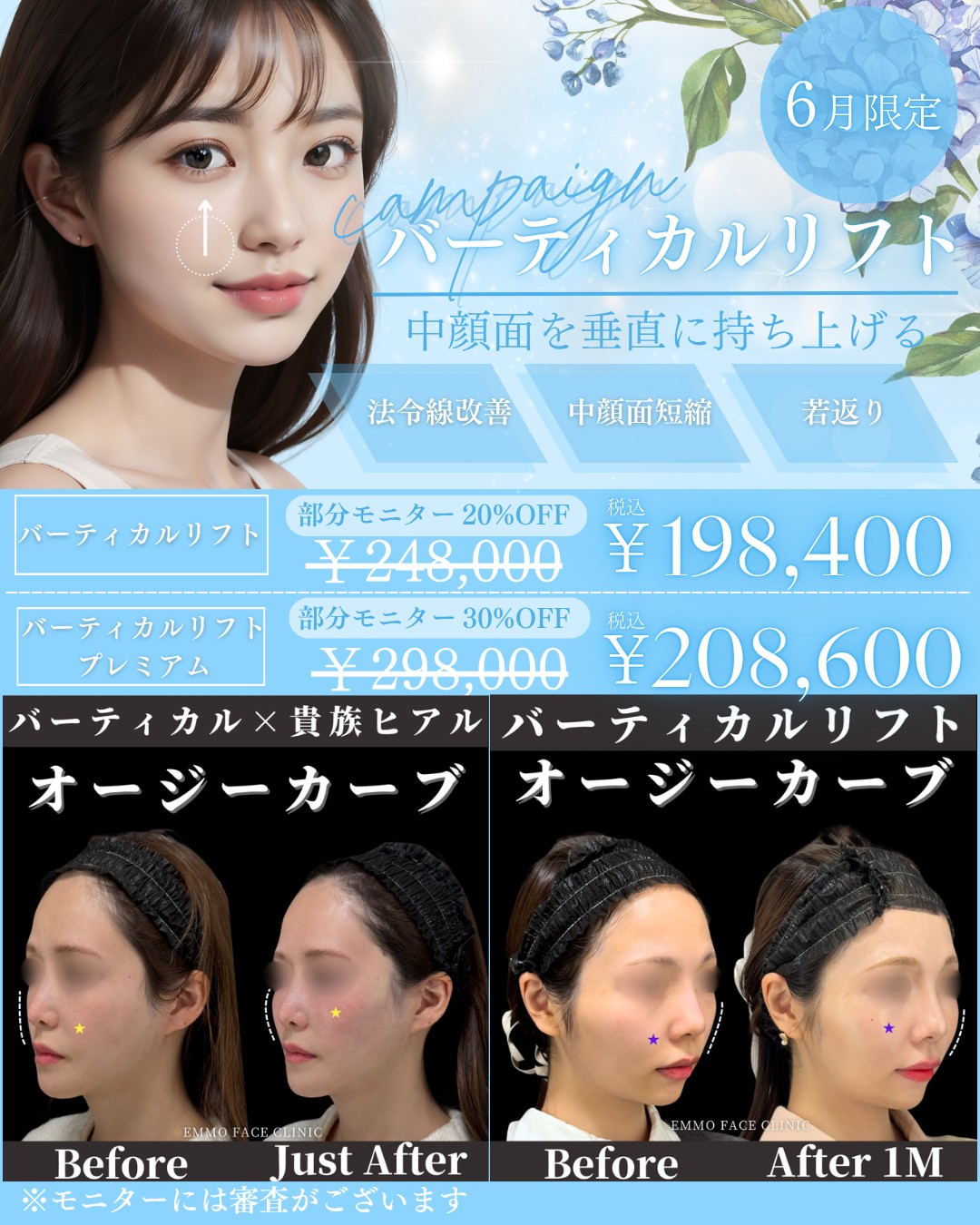 キャンペーン