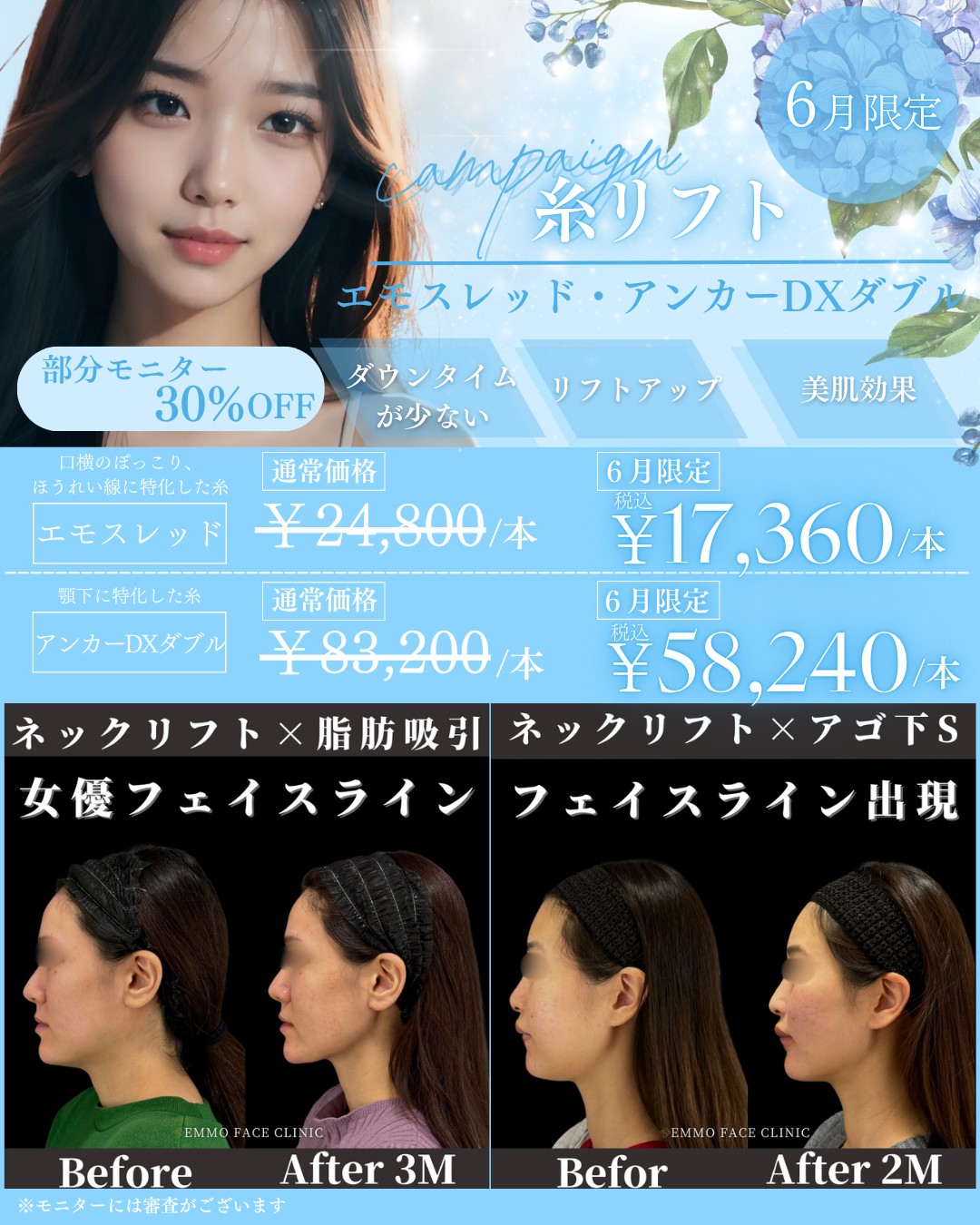 キャンペーン