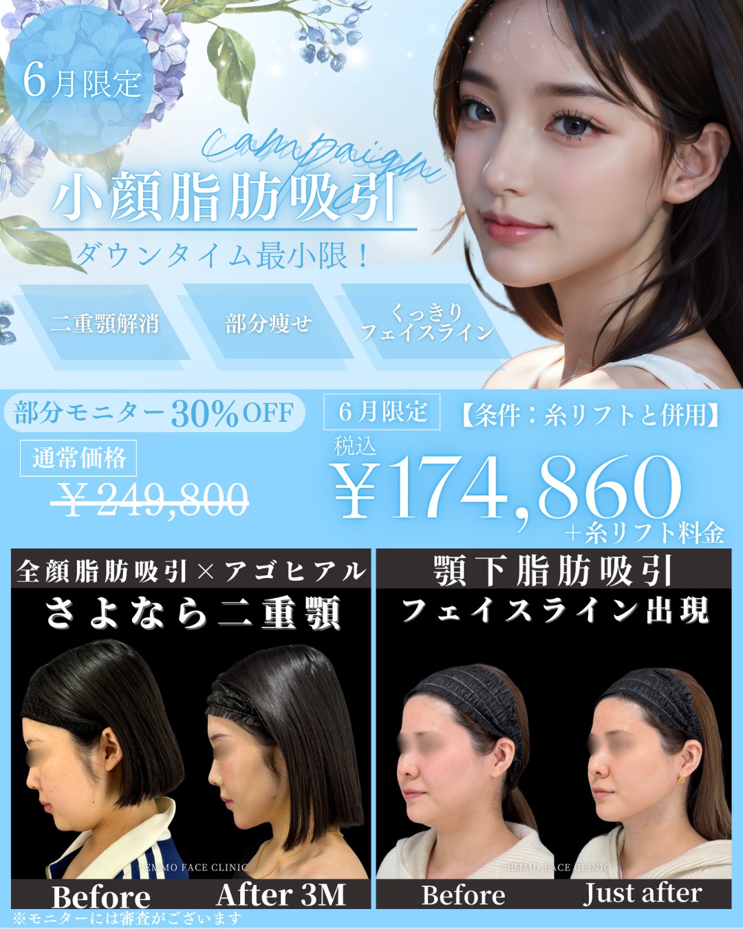 キャンペーン