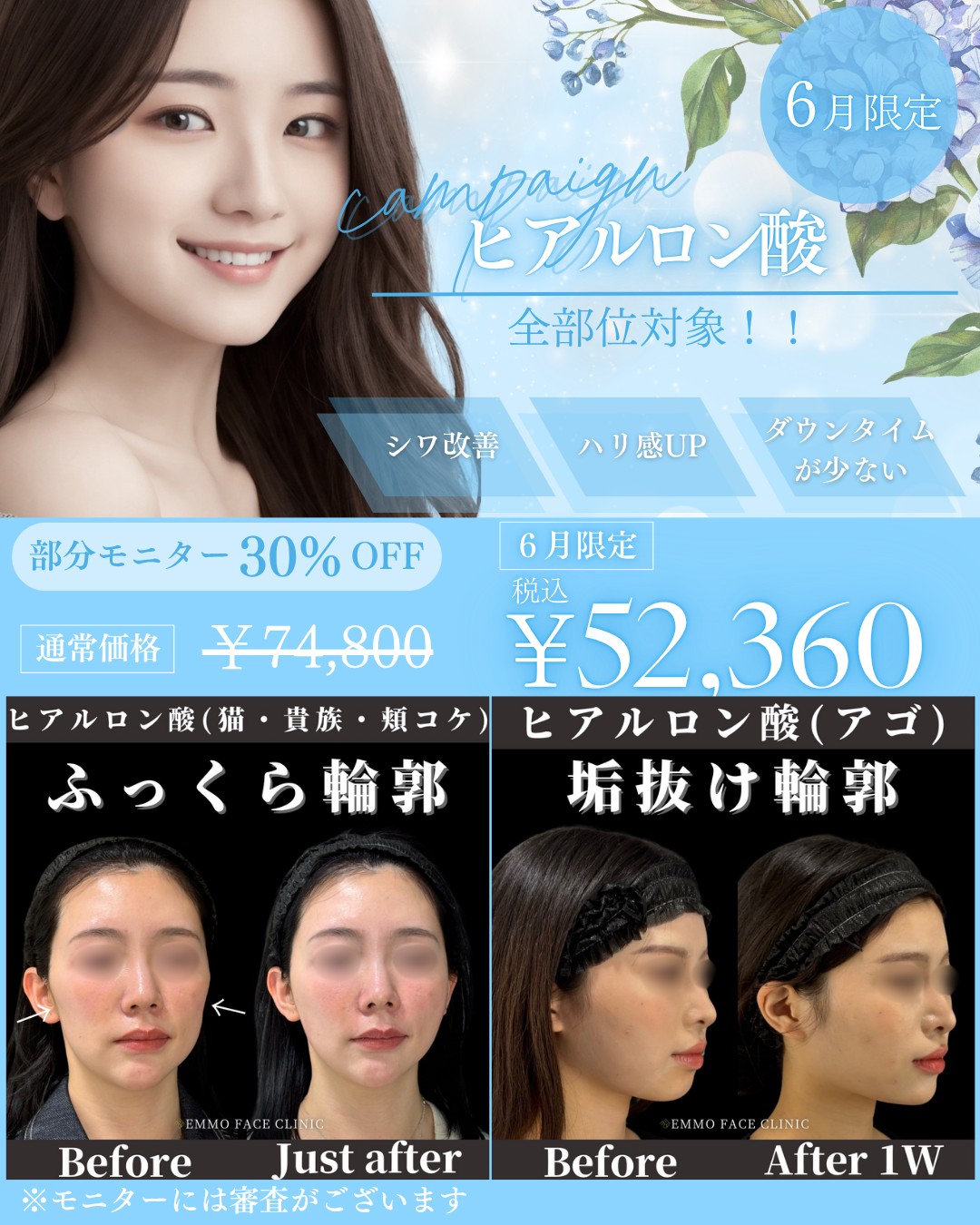 キャンペーン