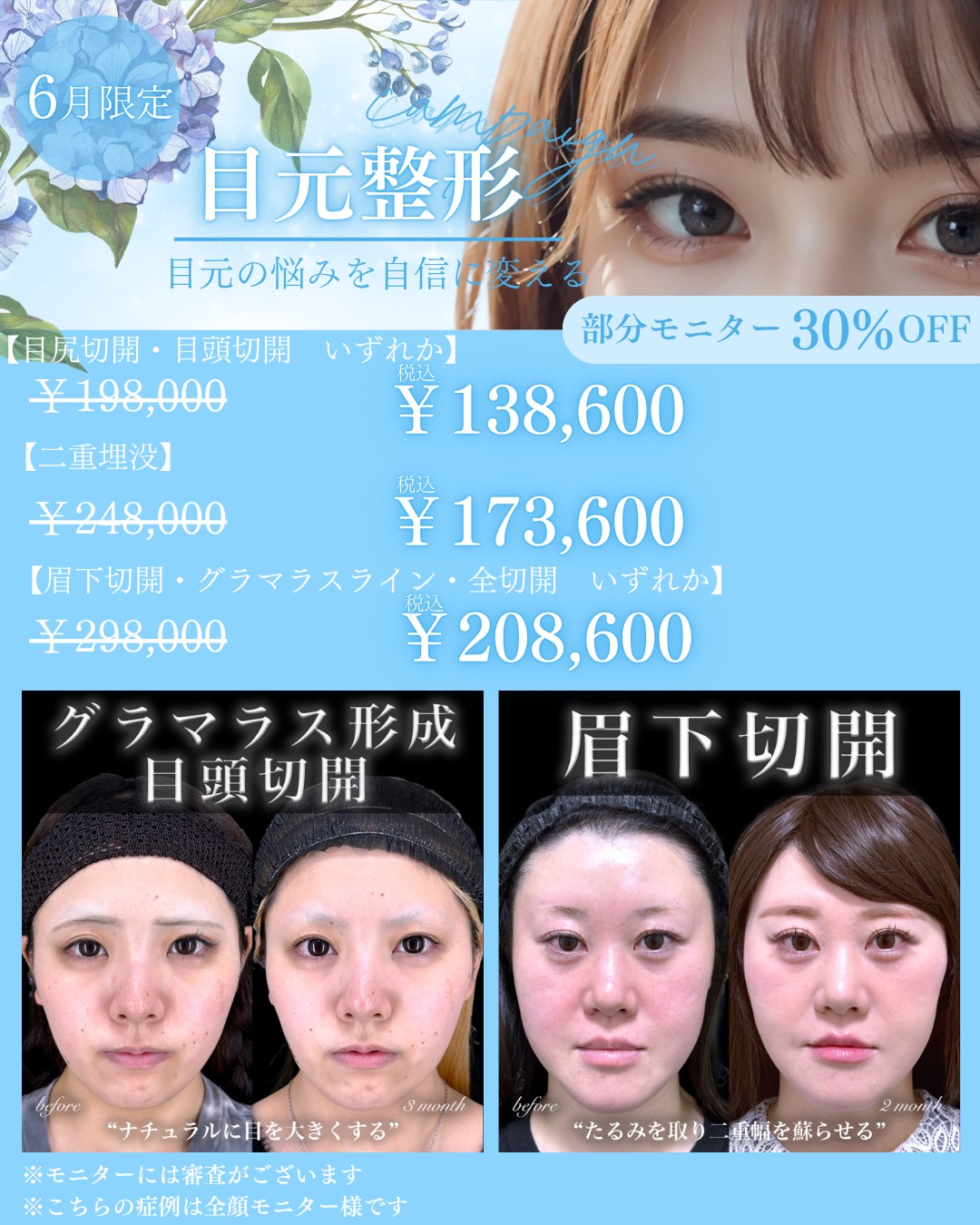 キャンペーン