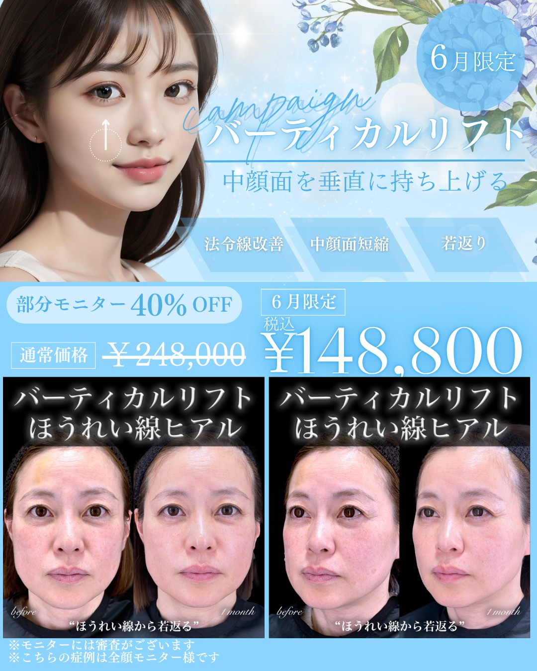 キャンペーン
