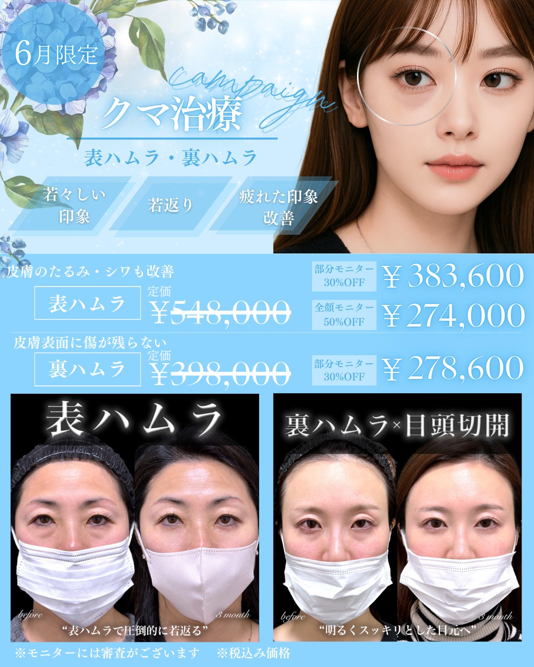 キャンペーン