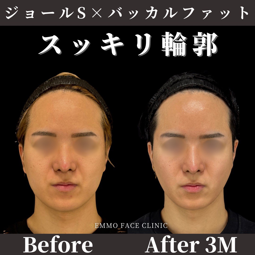 症例写真01