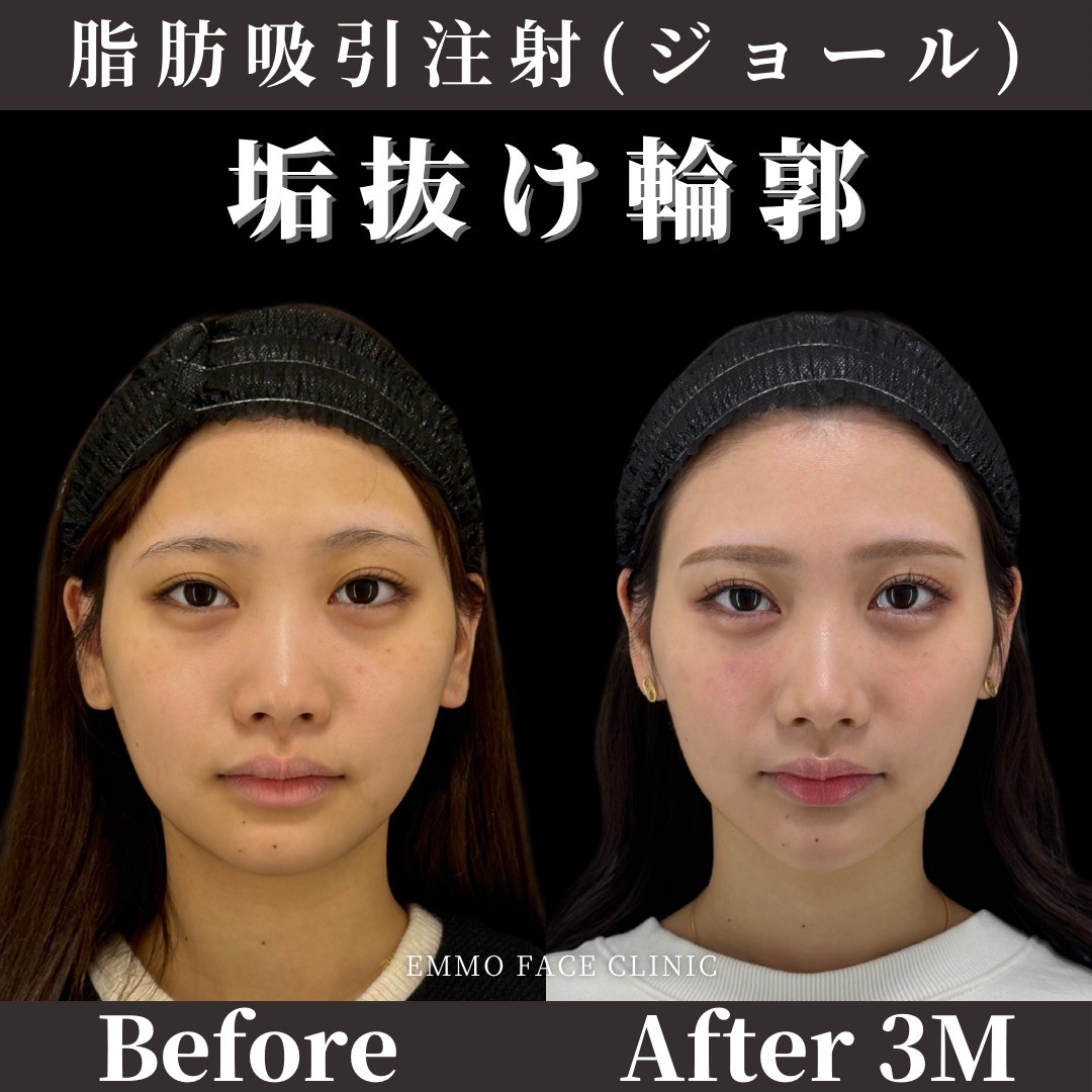 症例写真02
