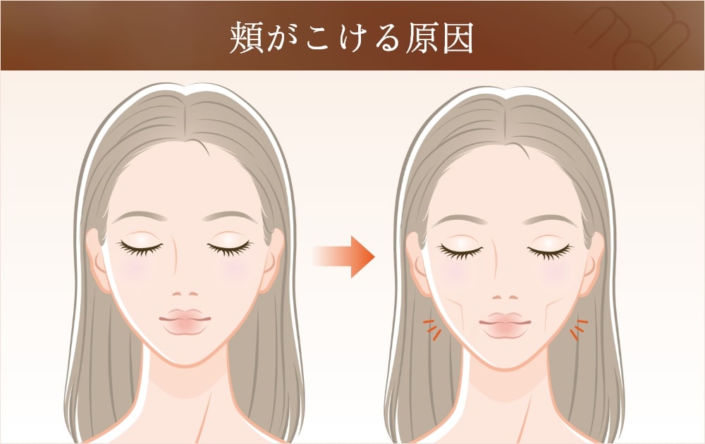 頬がこける理由