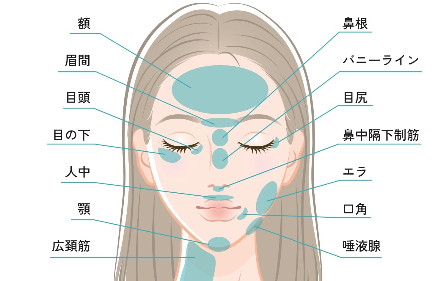 ボトックス注射