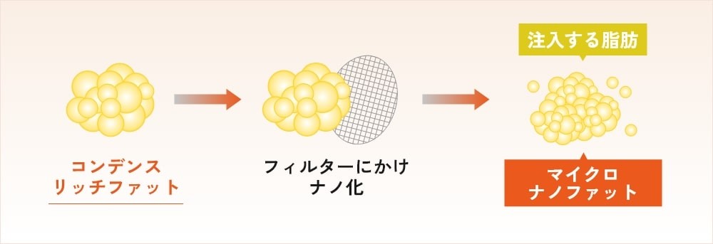 マイクロナノファット