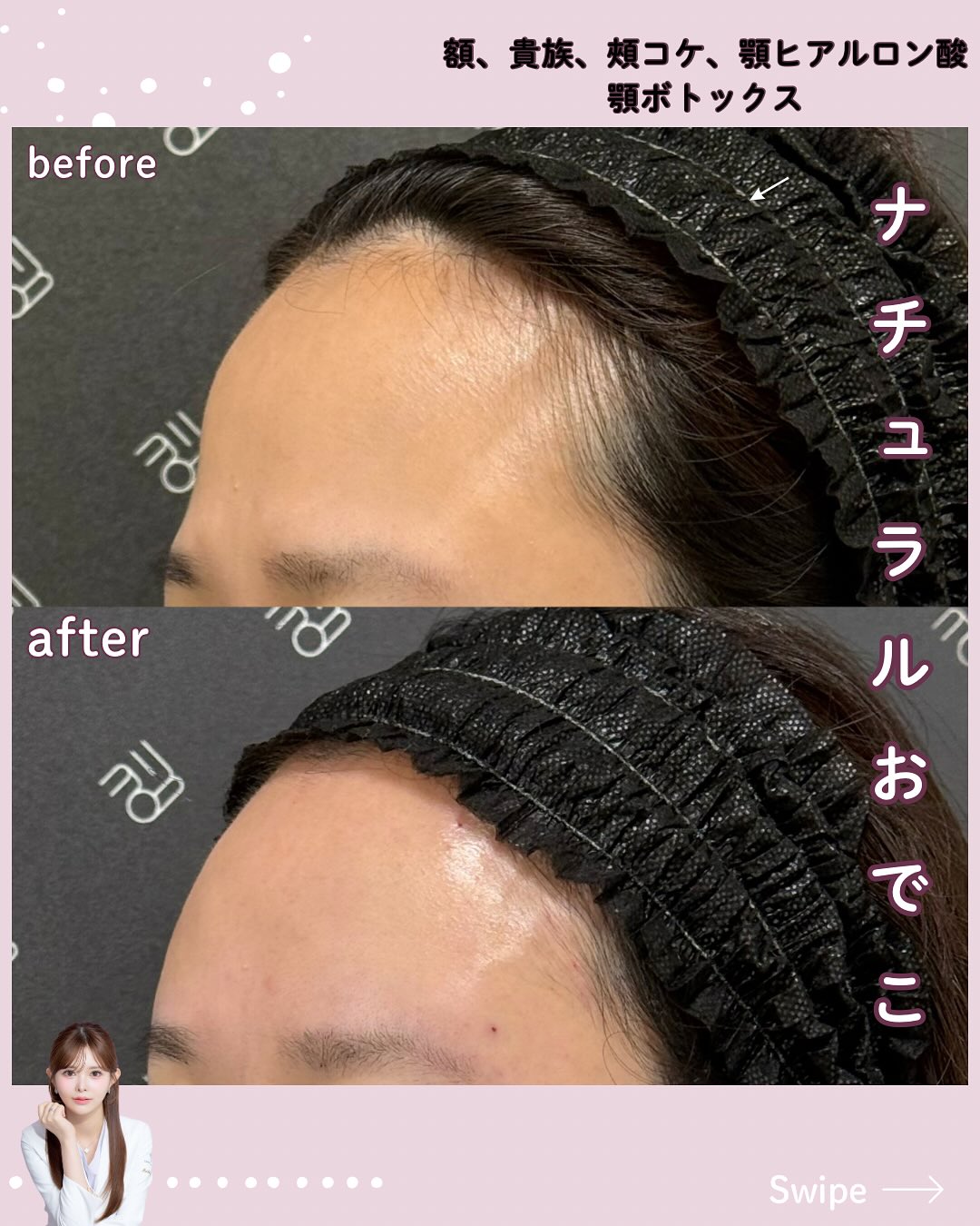 カスタマイズヒアル