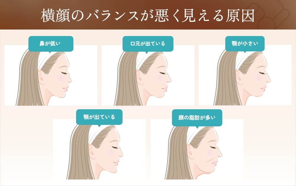 ブサイクな横顔に見える人に多い特徴