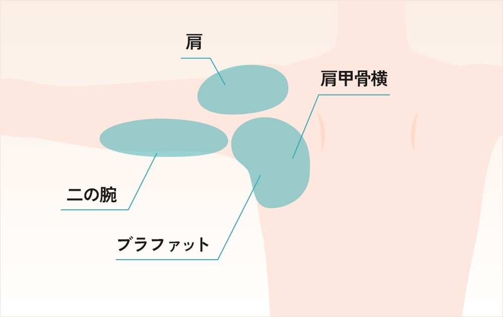 施術箇所とダウンタイム