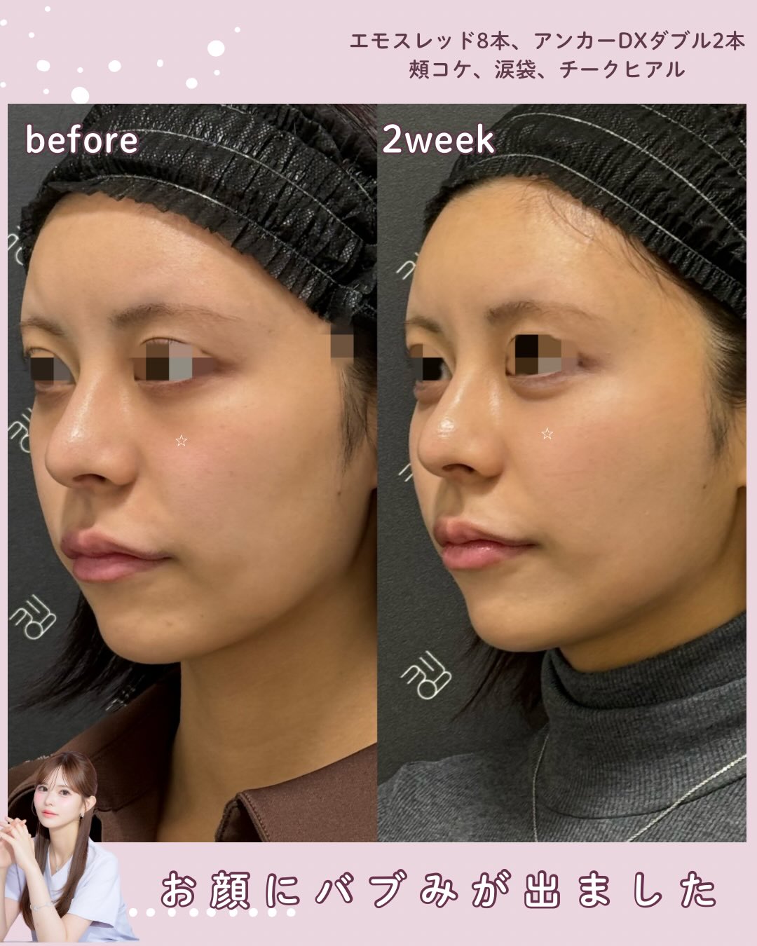 EMMO FACE CLINIC｜大宮 東京三田 大阪梅田 の美容外科・美容皮膚科