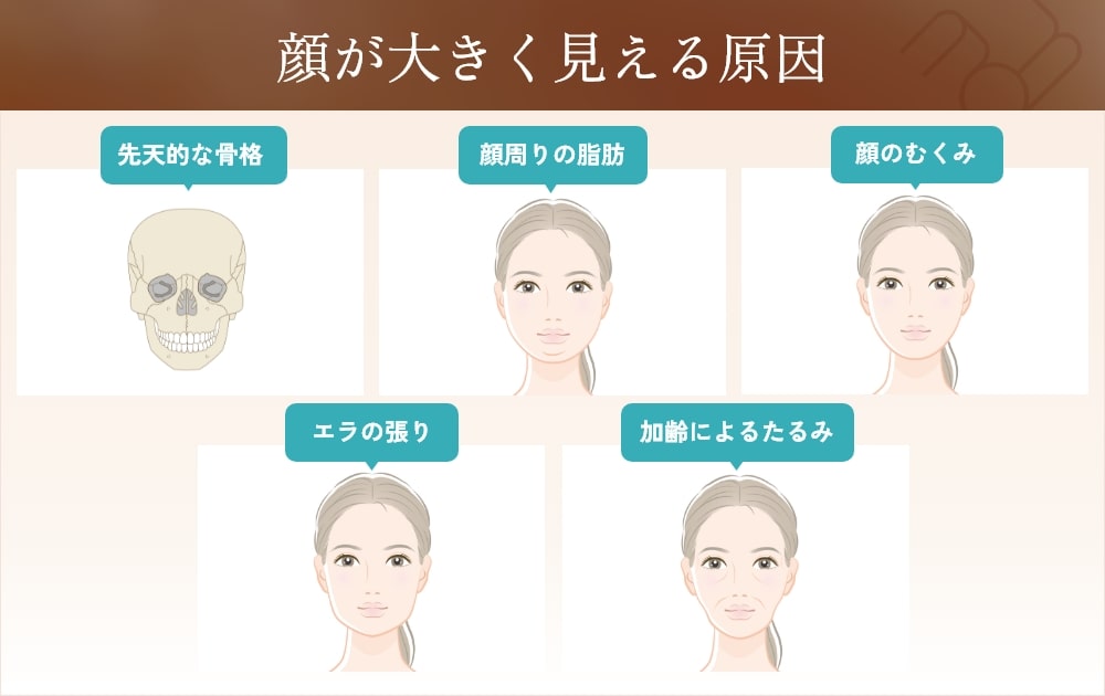顔が大きく見える原因