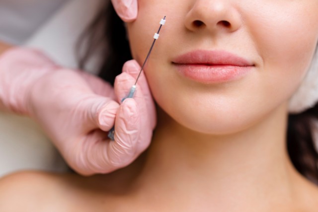 糸リフトの施術を受ける女性の顔と医療用具