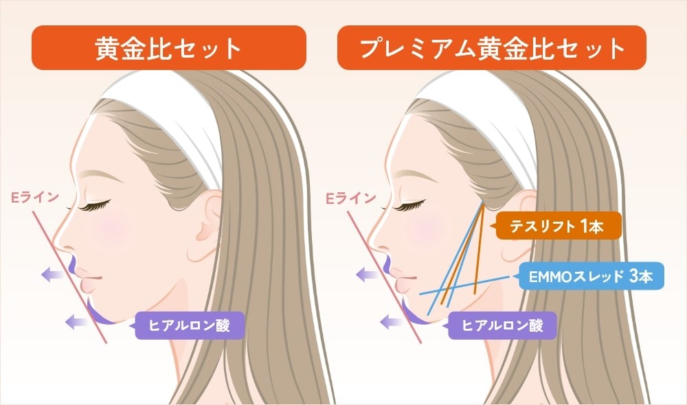 美容医療の施術比較黄金比セットとプレミアム黄金比セット